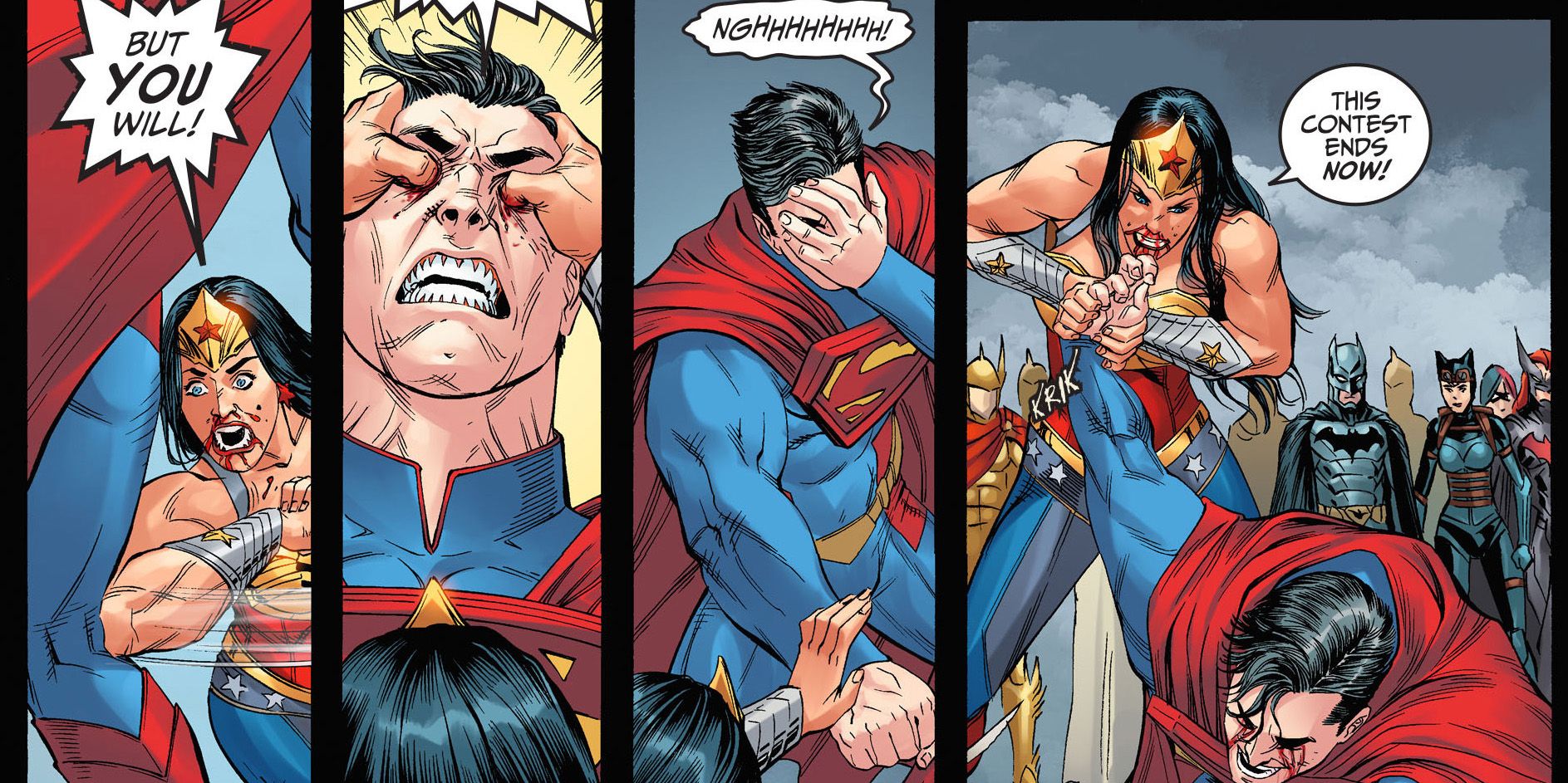 superman wonder woman arm