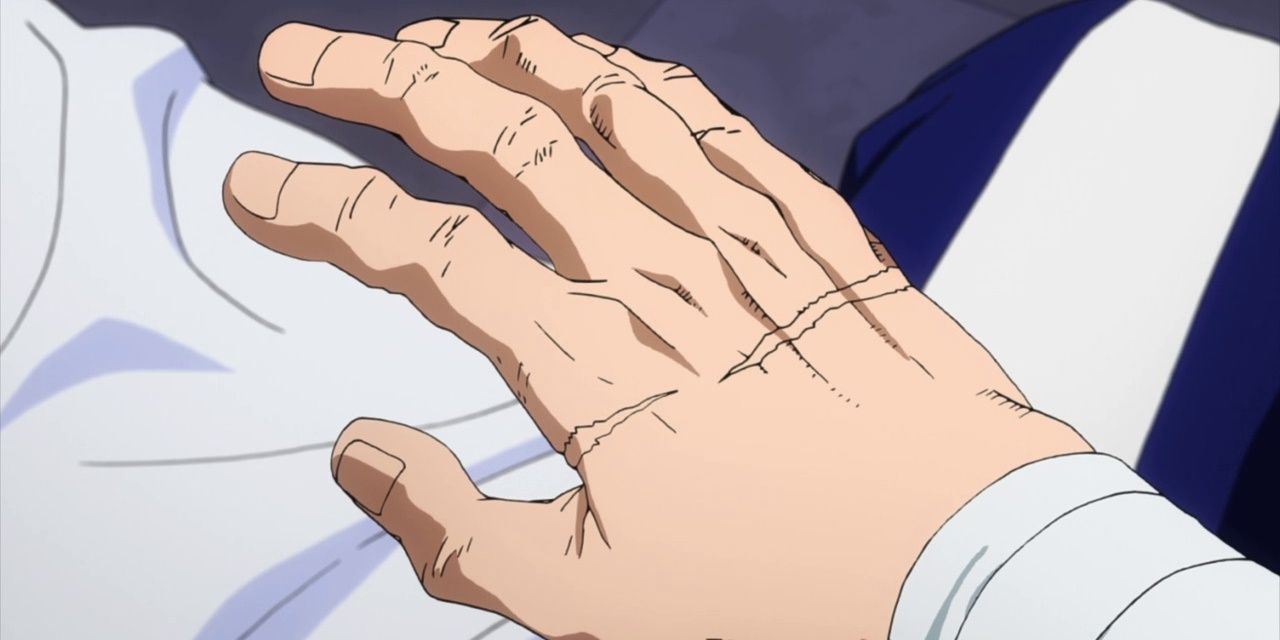 Iida's Scarred Hand