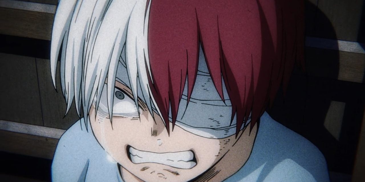 How Did Todoroki Get His Scar & More Questions About Him, Answered