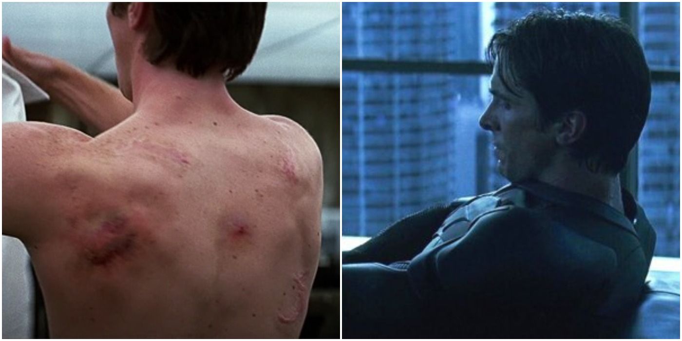 The physical and mental scars of being Batman in The Dark Knight