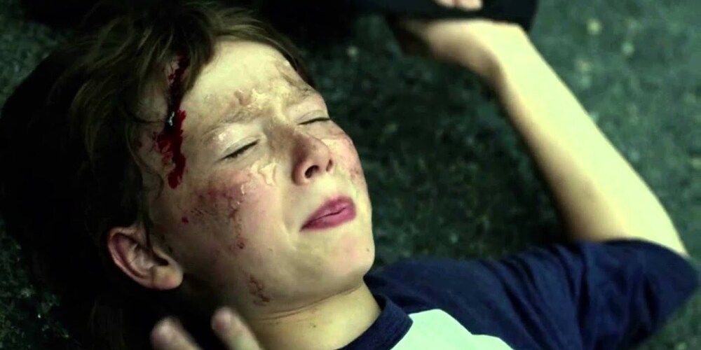 Daredevil Injury as a Child