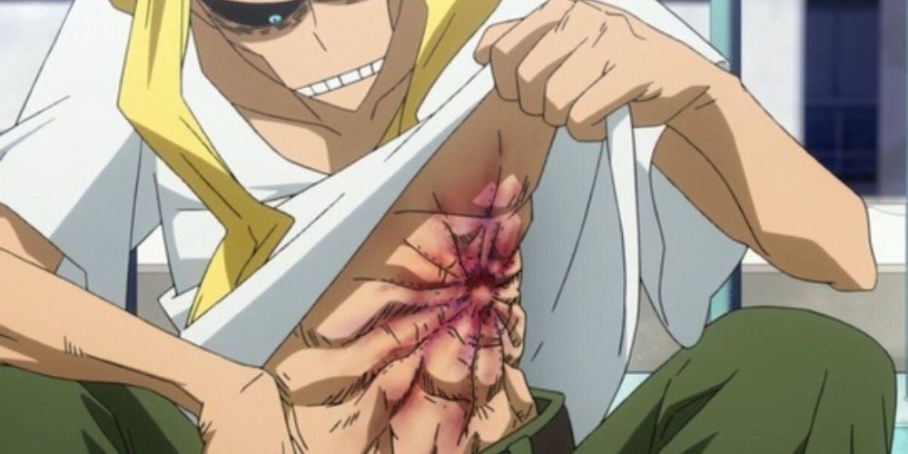 All Might shows his injured midsection