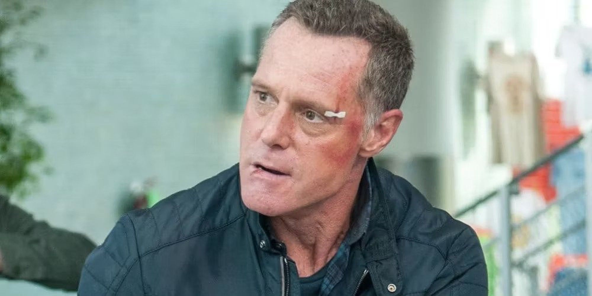 Hank Voight with a bruised face and a bandaid from Chicago Fire