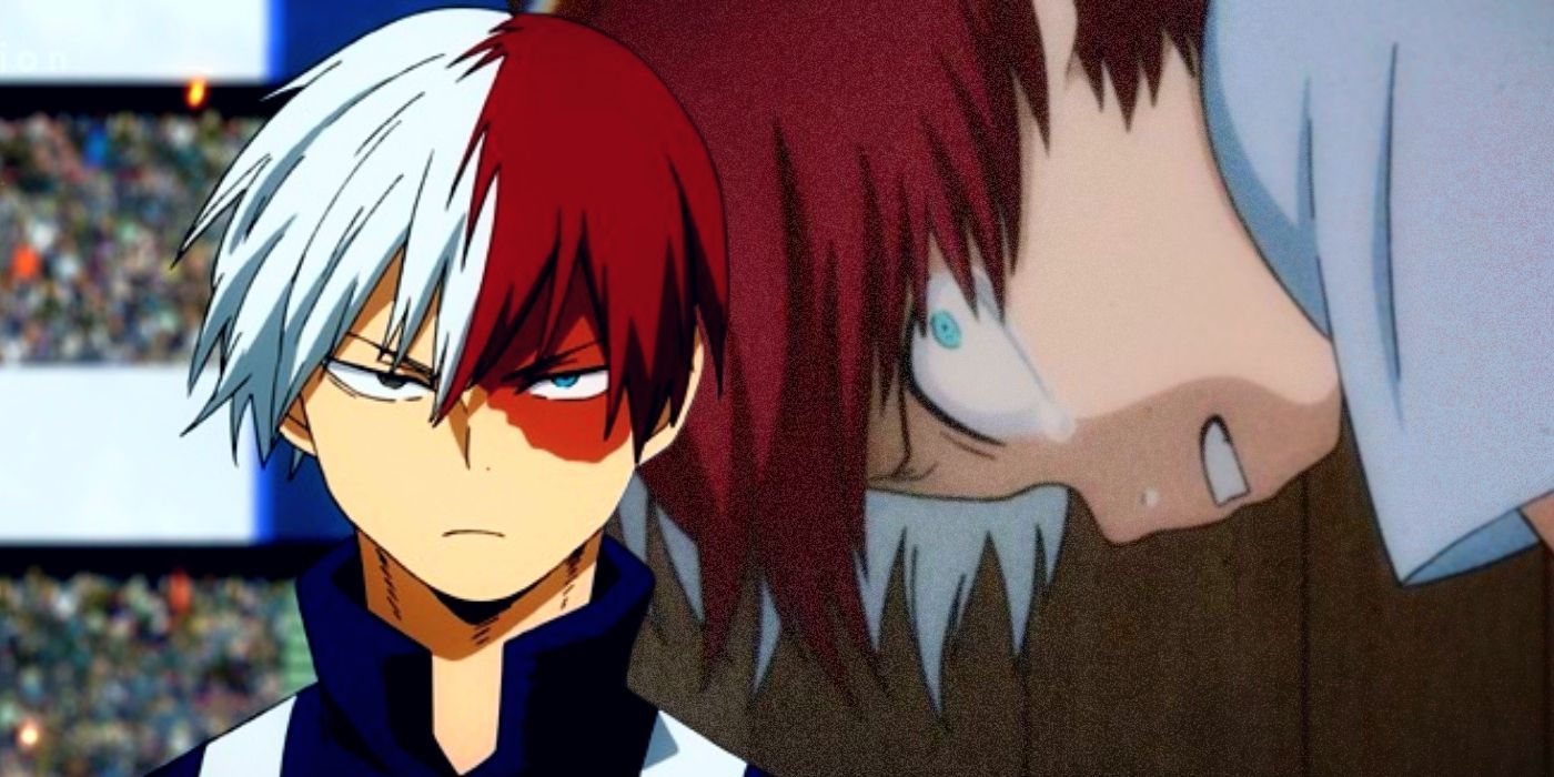 What kind of burn does Todoroki have  Quora
