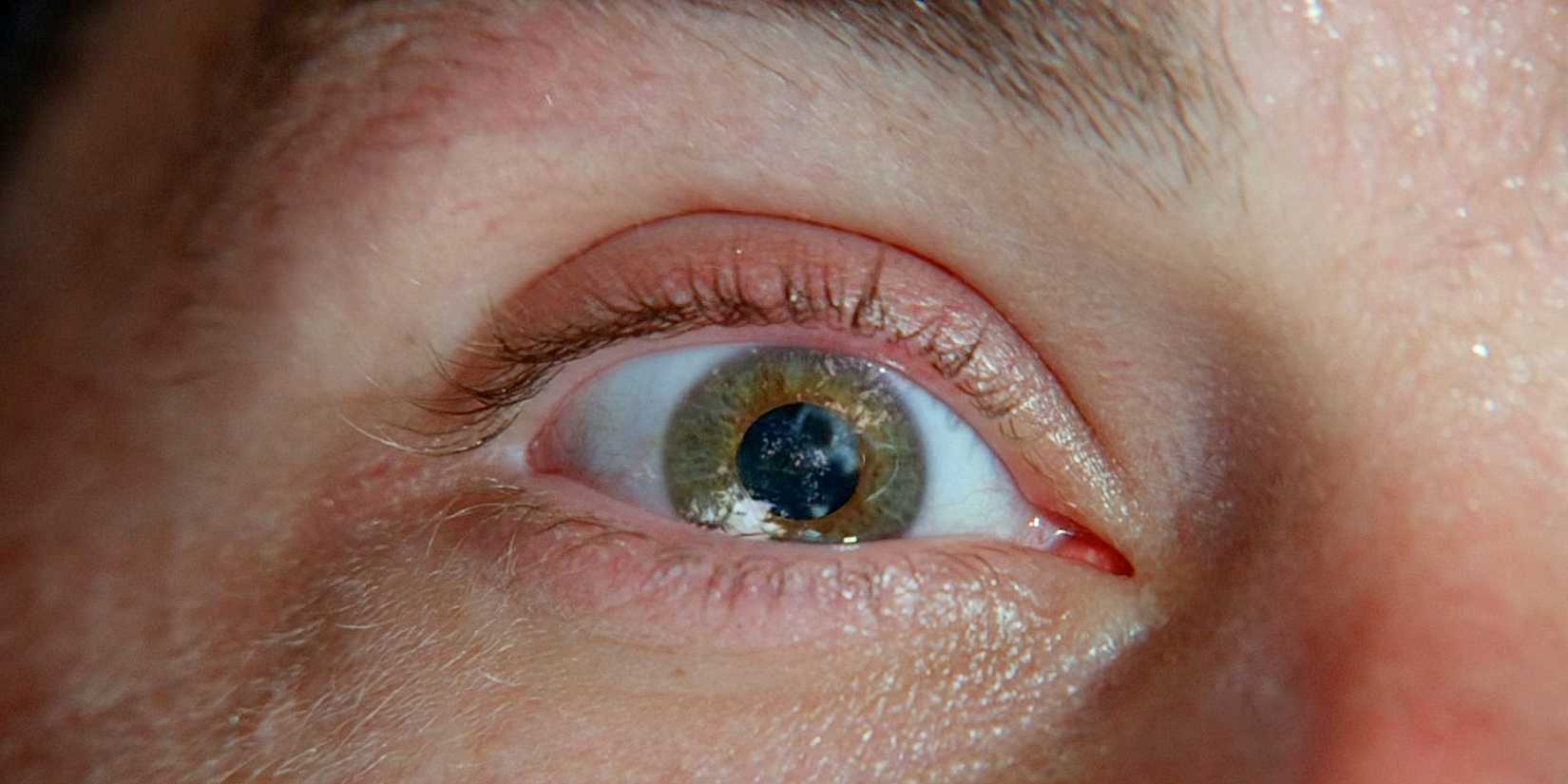 Close up on Jack Shephard's eye from the first shot of the Lost series pilot