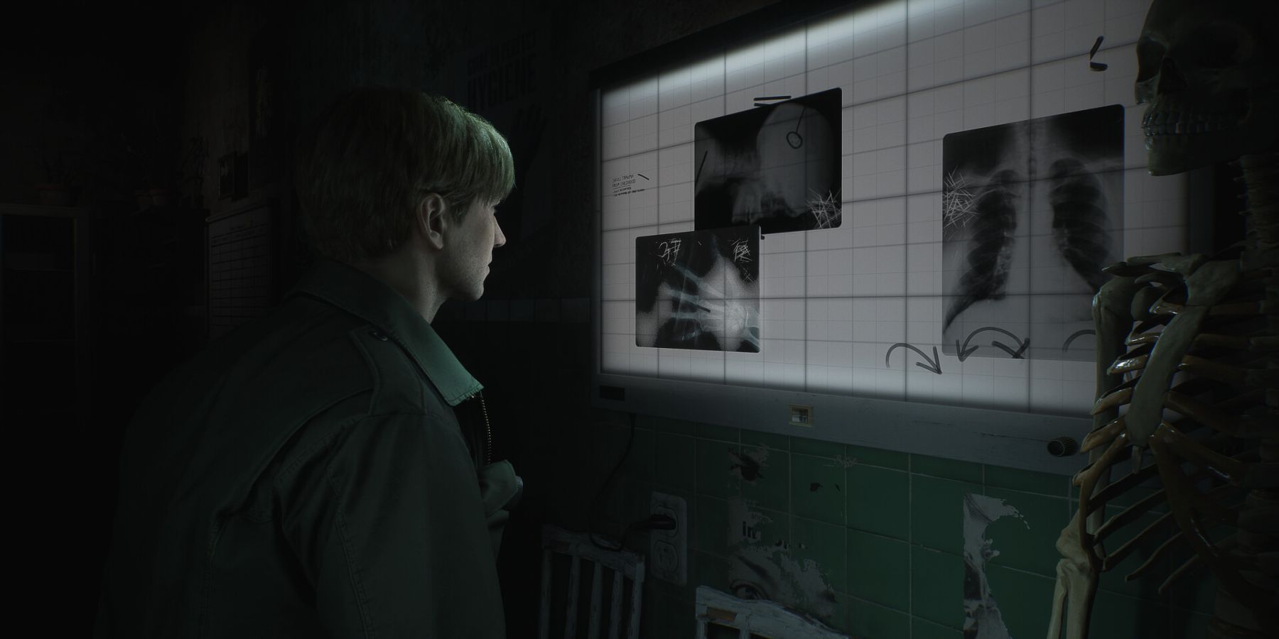 Silent Hill 2 Remake: Which Difficult Level Should You Pick?